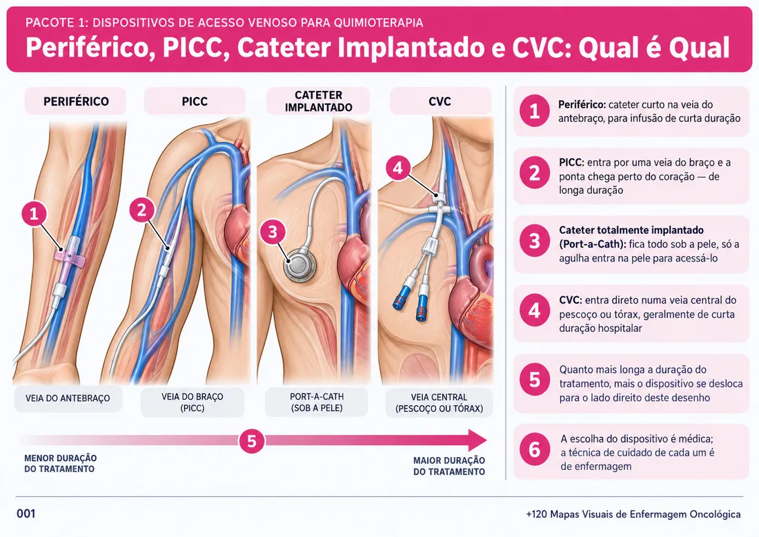 Mapa 001: Periférico, PICC, Cateter Implantado e CVC: Qual é Qual