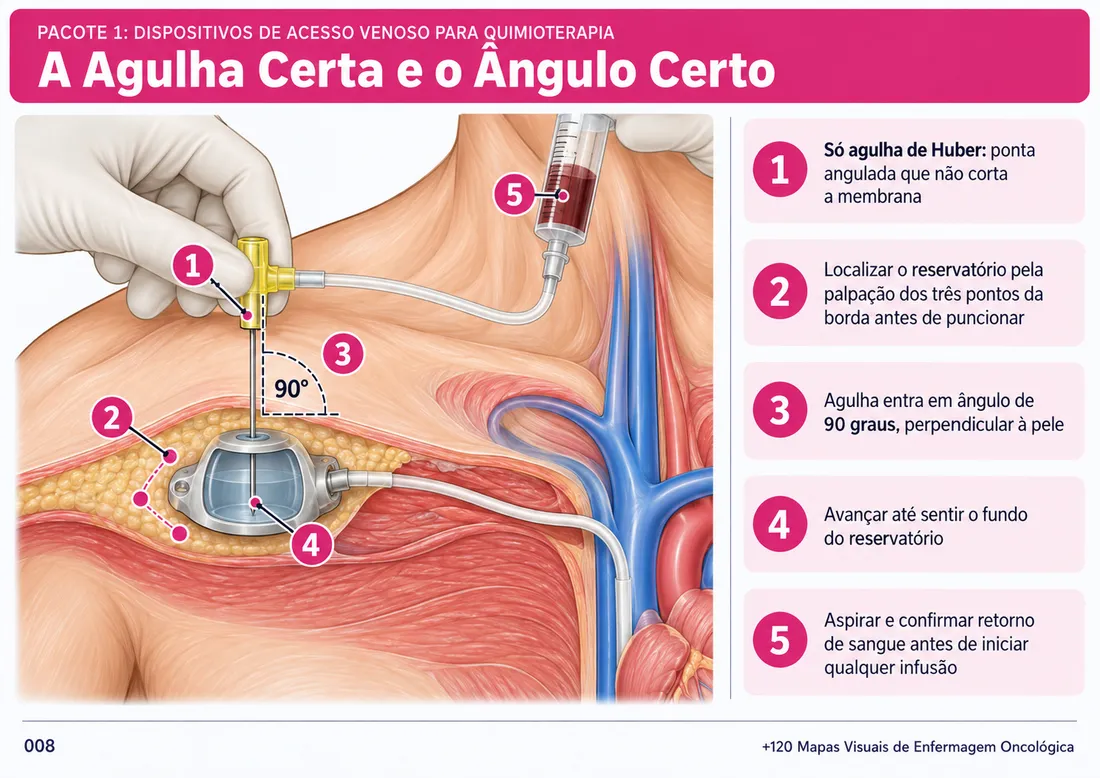 Mapa 008: A Agulha Certa e o Ângulo Certo